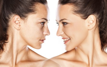 Understanding Ultrasonic Rhinoplasty: The Modern Approach to Nose Surgery in Dubai