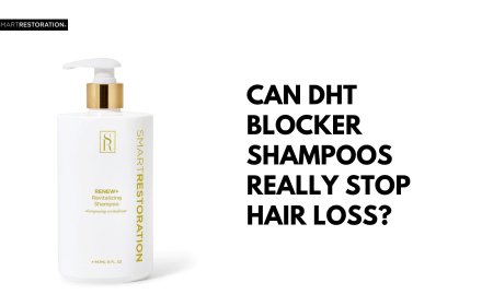 Can DHT Blocker Shampoos Really Stop Hair Loss?