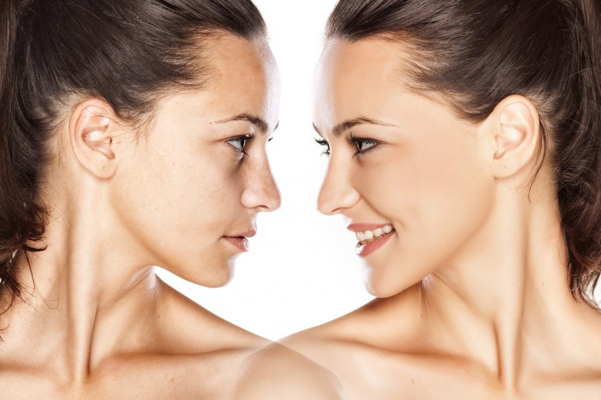 Understanding Ultrasonic Rhinoplasty: The Modern Approach to Nose Surgery in Dubai