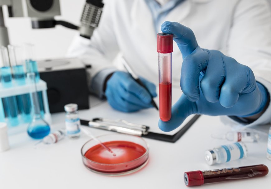 Affordable & Reliable Blood Test in Bangalore – Home Collection Available