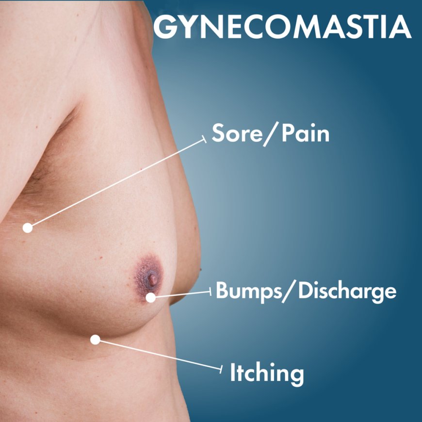 Where to Treat Gynecomastia in Islamabad: Best Clinics and Doctors