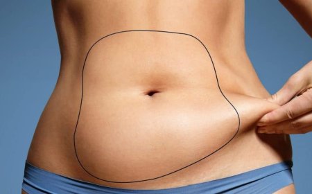 Need to Know Liposuction Tips from Best Liposuction Surgeons in Dubai