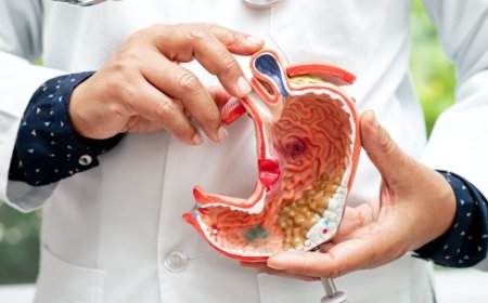 How a Skilled Bariatric Surgeon Can Improve Long-Term Weight Loss Success