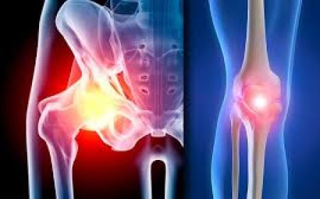 Knee vs. Hip Replacement: Which Joint Surgery Do You Really Need?