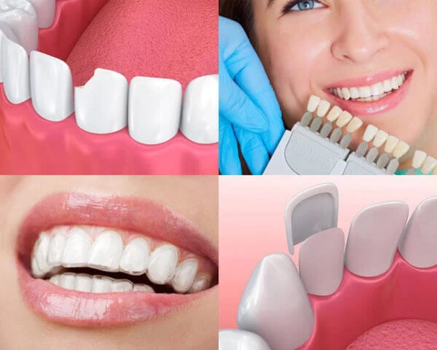 Revitalize Your Smile: The Ultimate Guide to Fixed Dentures in Tampa