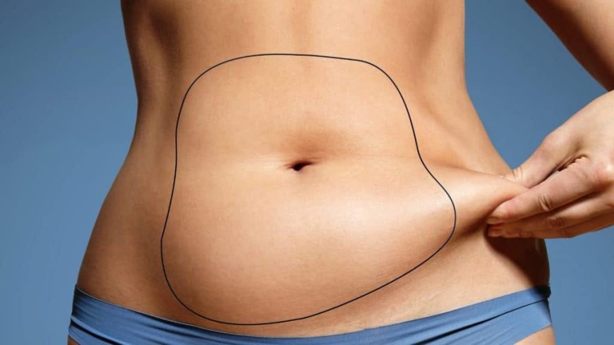 Need to Know Liposuction Tips from Best Liposuction Surgeons in Dubai